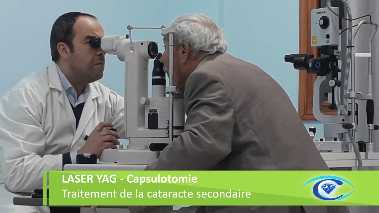 Traitement de la cataracte secondaire par le laser Capsulotomie YAG :
