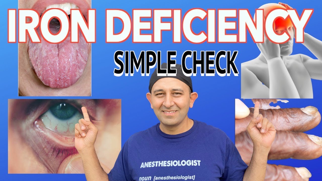 6 Warning Signs You Have Iron Deficiency Anemia