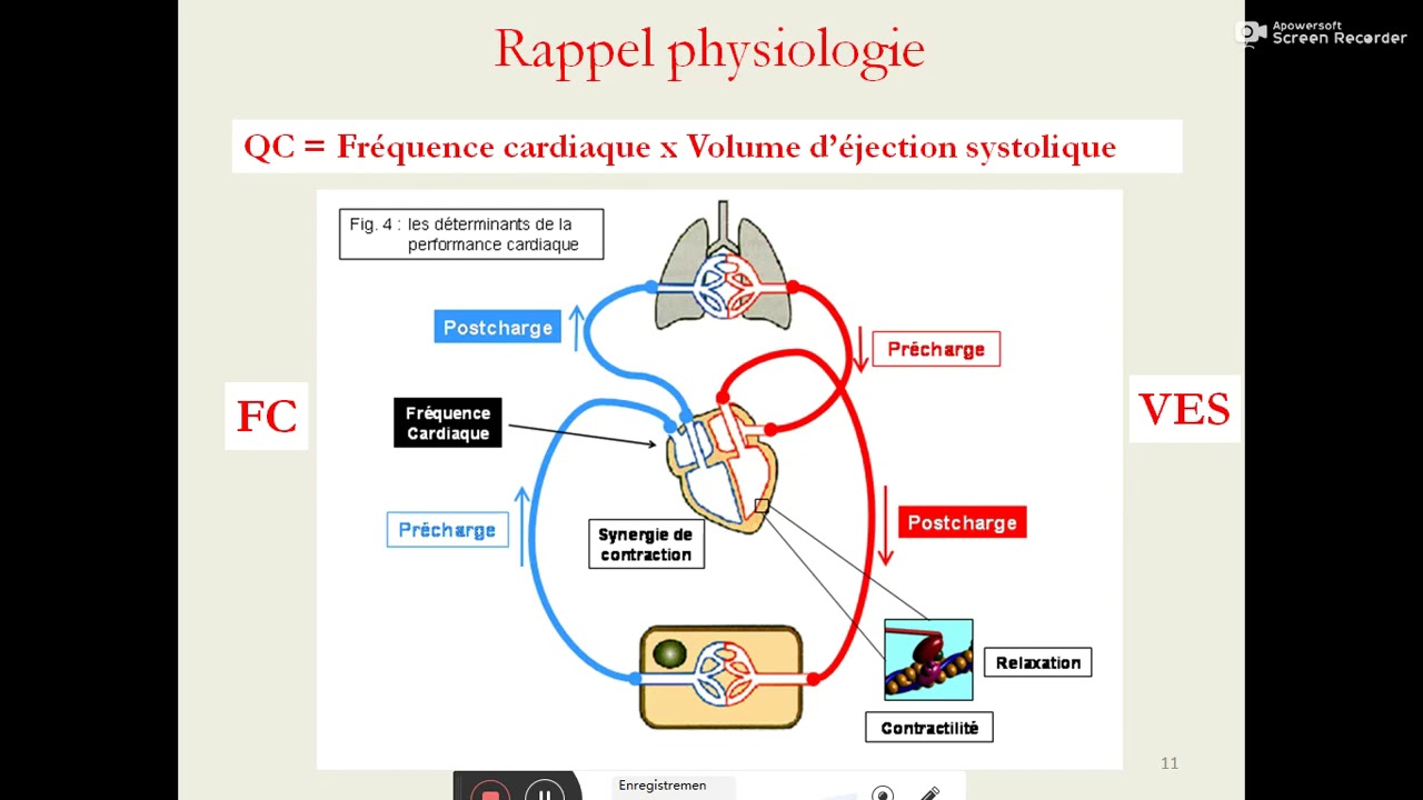 Insuffisance cardiaque droite