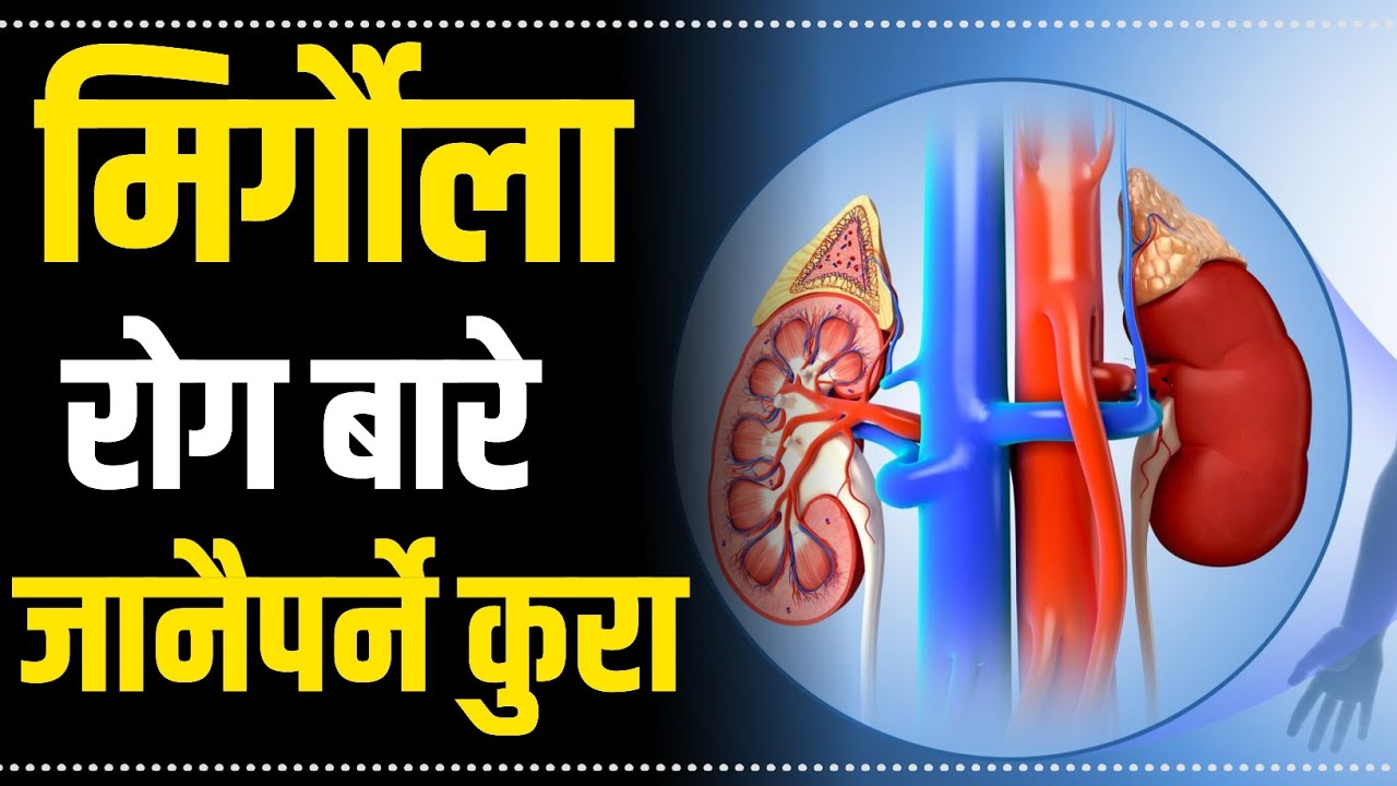 मिर्गौला रोगी निको  हुन्छ ?? 🔵🤔 || Kidney disease in nepali