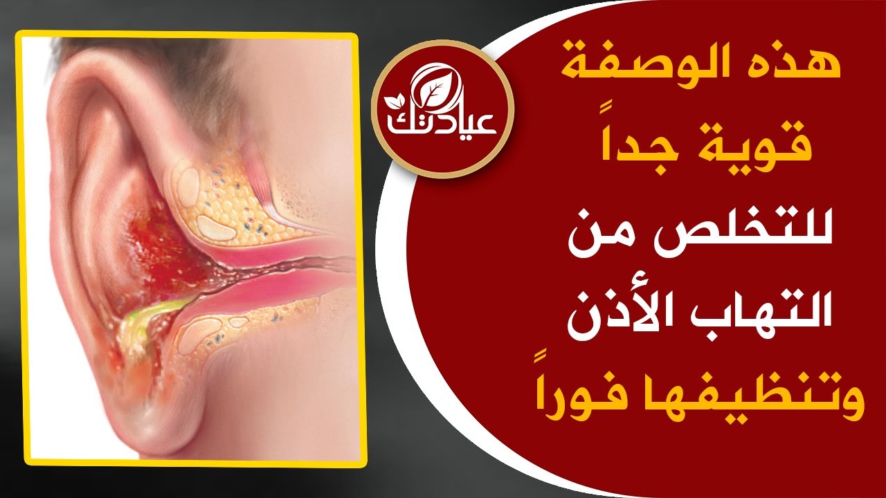 هذه الوصفة تعالج التهاب الاذن بأسرع مما تتوقع نظف أذنك بهذه الطريقة وستتعجب مماستراه في هذا الفيديو