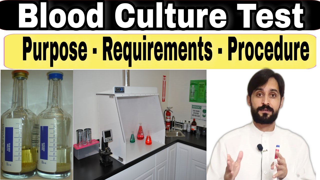 Blood culture test || Purpose || Requirements and Procedure