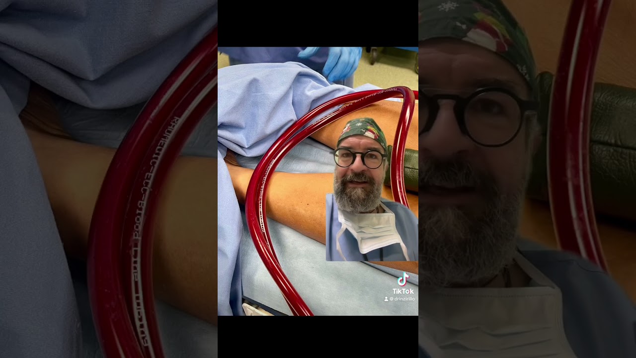 #ecmo