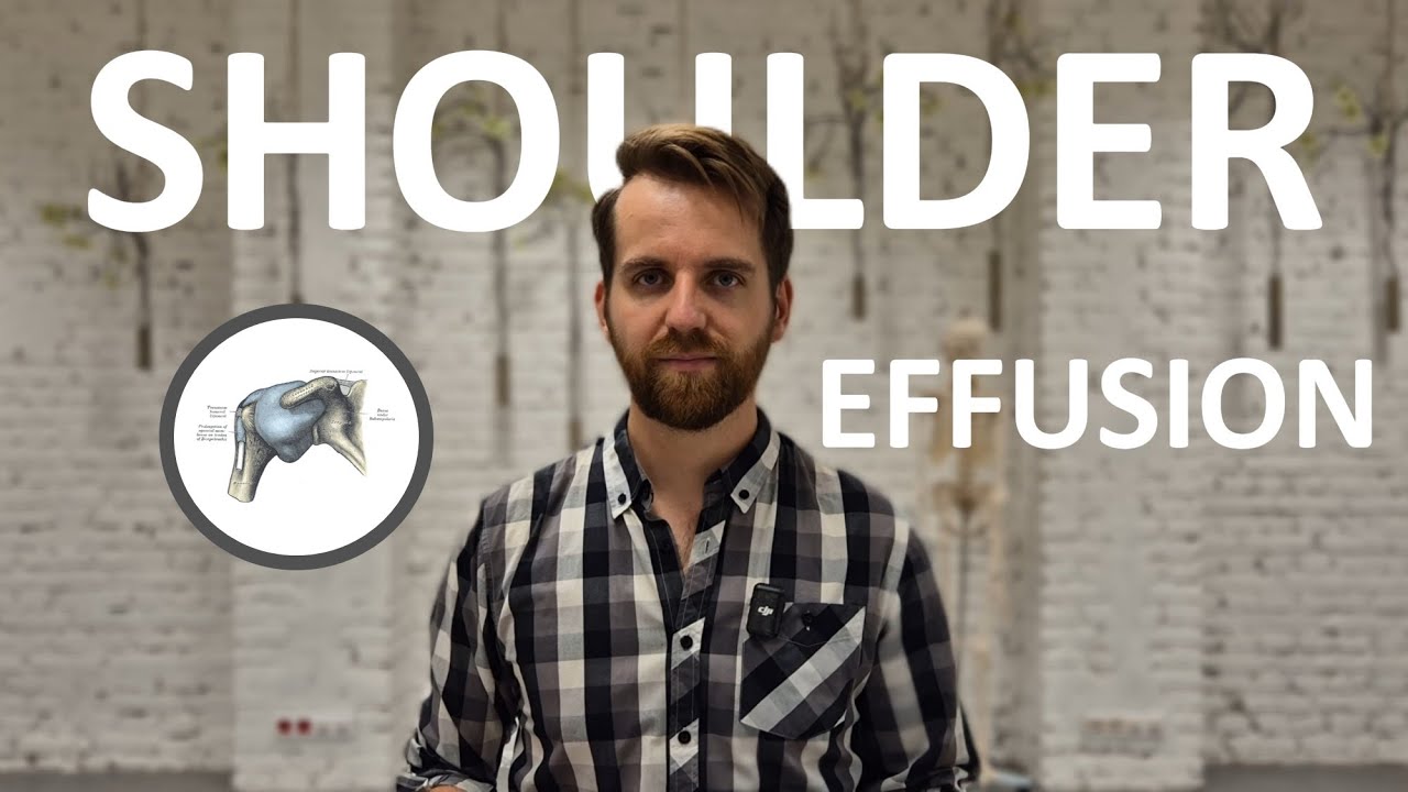 SHOULDER JOINT EFFUSION: How To Find It With Ultrasound
