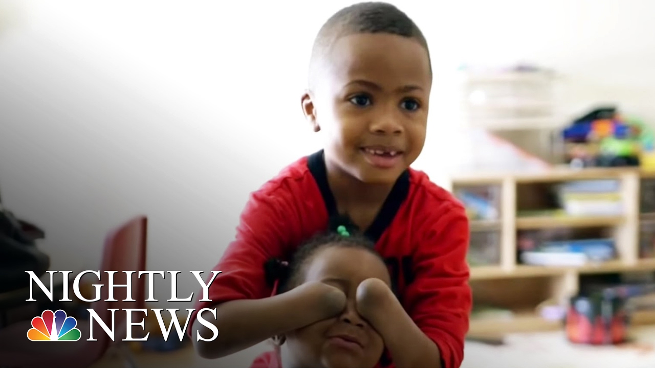 Courageous Boy Receives World&rsquo;s First Double Hand Transplant | NBC Nightly News