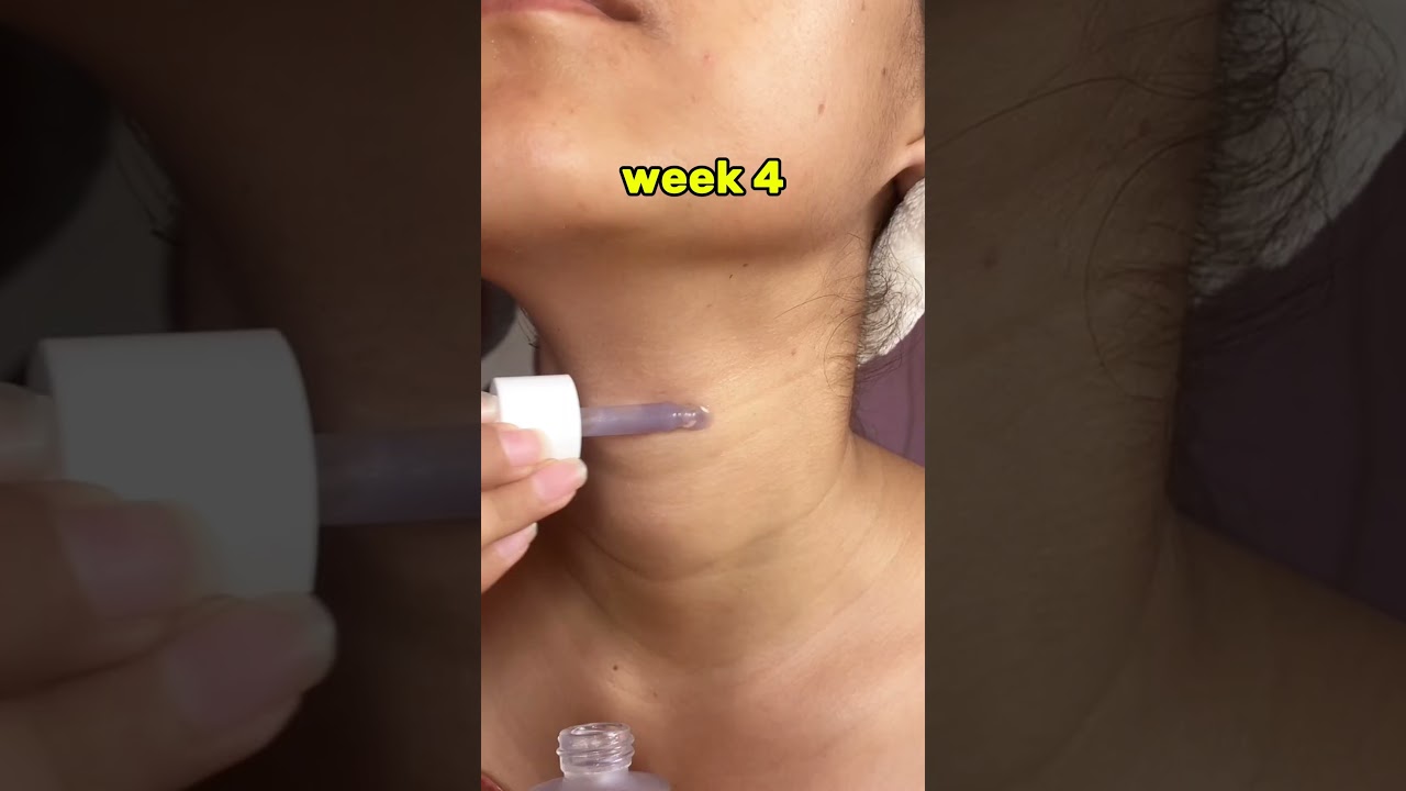 1 Serum to Fade Fine Lines – My Secret’s Out! ✨ | Click the Link 👇