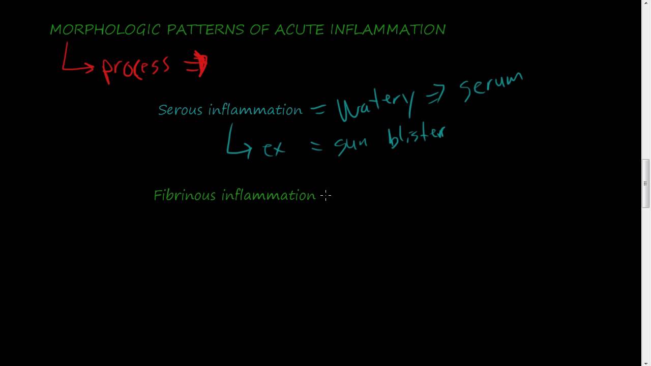 #23 - MORPHOLOGIC PATTERNS OF ACUTE INFLAMMATION - Serous, Fibrinous, Suppurative inflammation