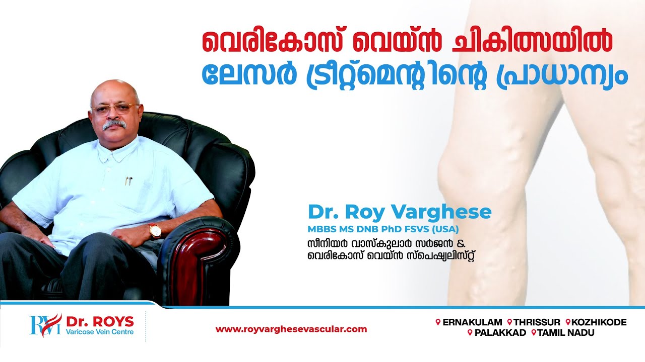 വെരികോസ് വെയിനിന്‌ ഏറ്റവും ഫലപ്രദമായ ലേസർ ചികിത്സ | 𝗟𝗮𝘀𝗲𝗿 𝗧𝗿𝗲𝗮𝘁𝗺𝗲𝗻𝘁 𝗳𝗼𝗿 𝗩𝗮𝗿𝗶𝗰𝗼𝘀𝗲 𝗩𝗲𝗶𝗻