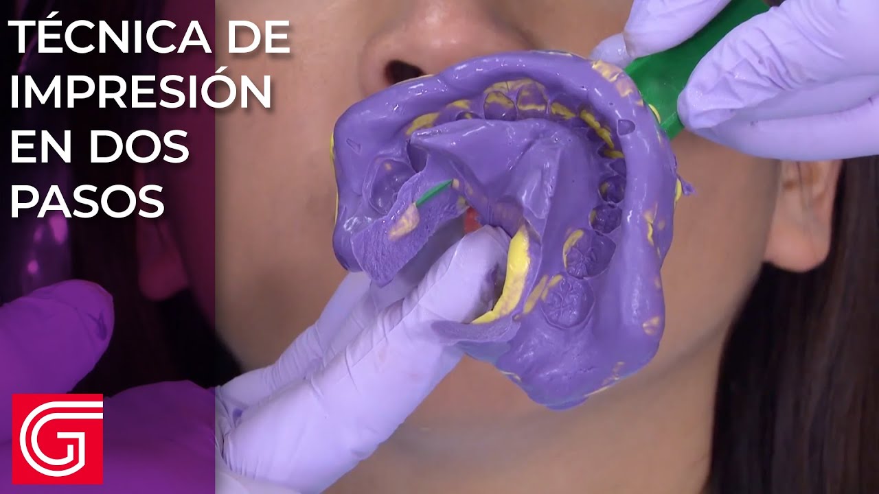 Técnica de impresión en dos pasos