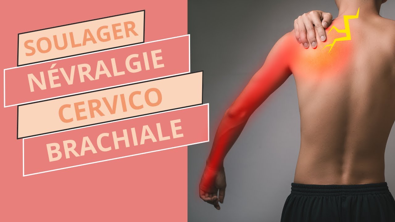 Névralgie Cervico-Brachiale : exercices simples pour soulager la douleur