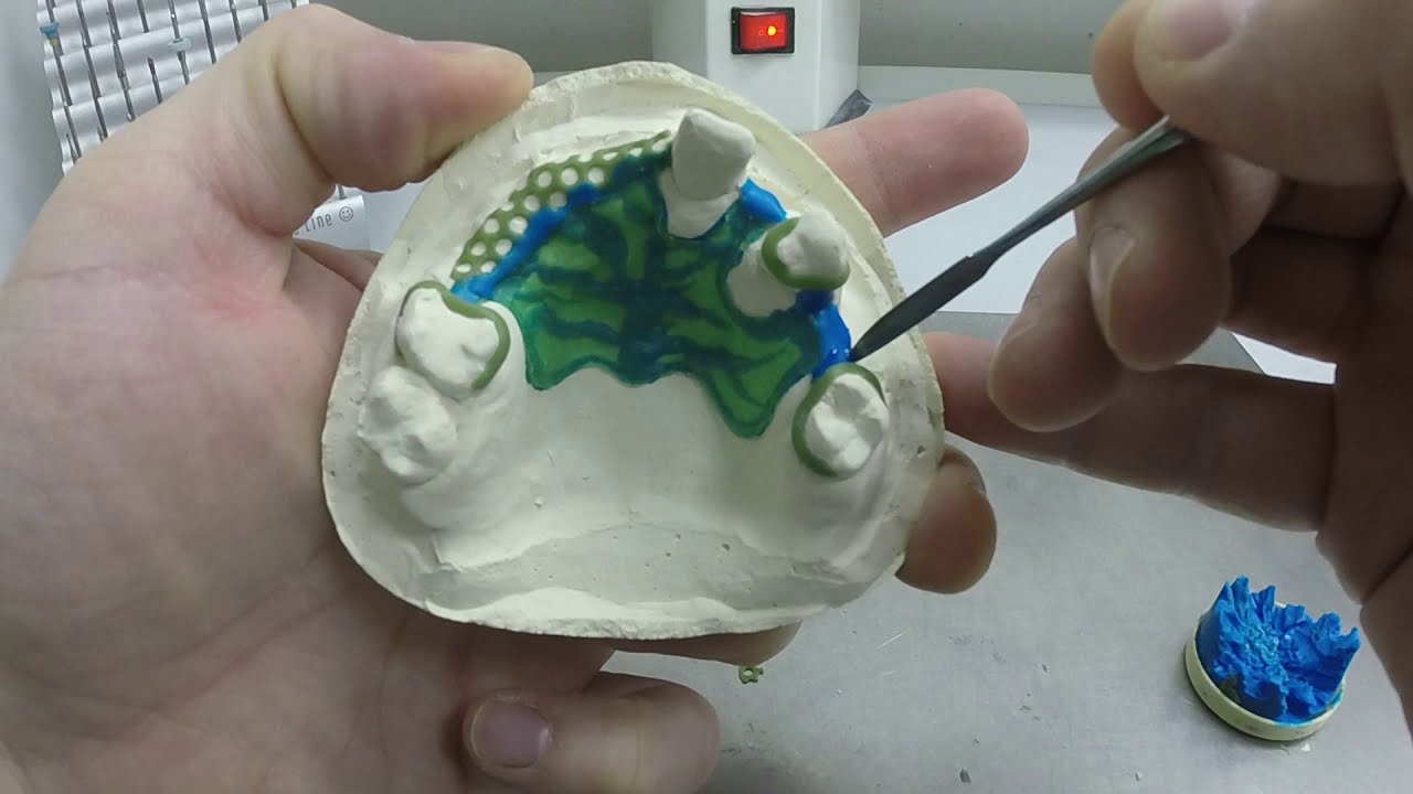 Wax modeling partial denture framework