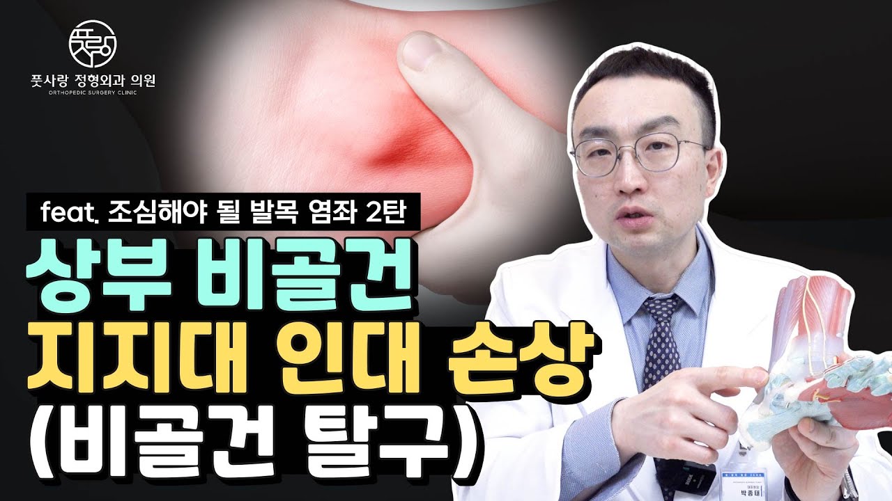 발목염좌 후 복숭아뼈 뒤쪽에서 #부산발목 통증? #상부비골건지지대파열