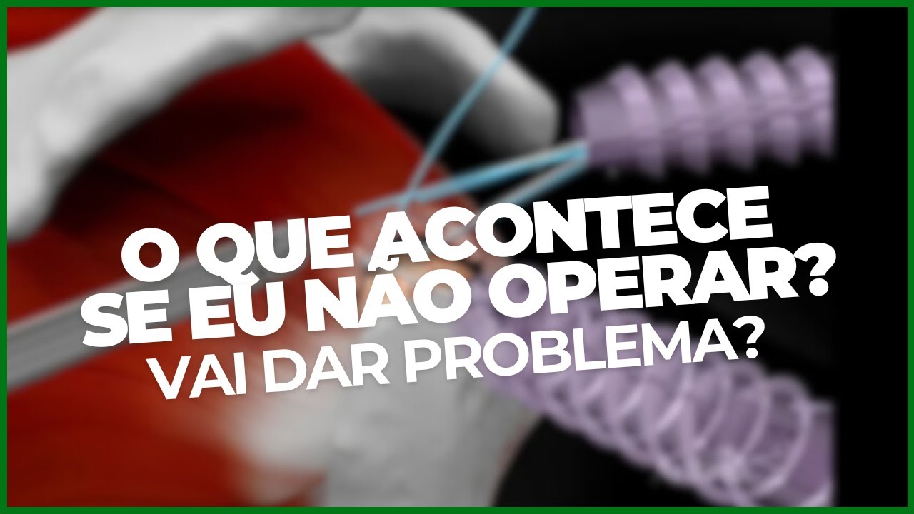 NÃO QUER FAZER CIRURGIA NO MANGUITO?? ›› DR RODRIGO PASTORE ‹‹