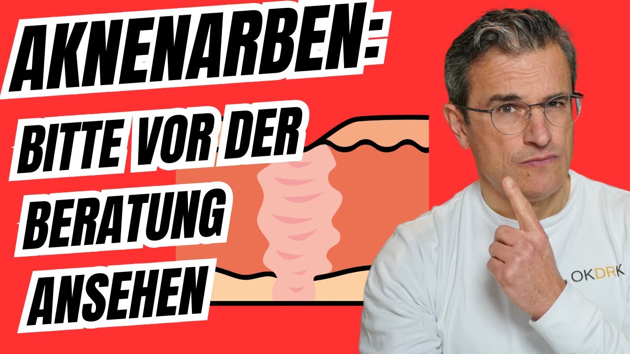 Effektive Behandlung von Aknenarben: Typen, Diagnose & Therapiemethoden. Dr. Robert Kasten