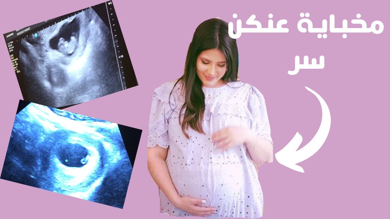 اكتشاف حملي عالكاميرا وزيارتي للطبيب | اشتقتلكن