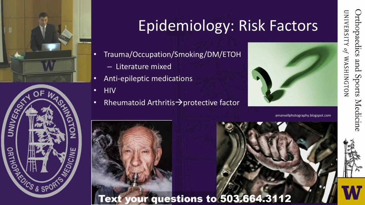 Dupuytrens Disease  Past, Present, and Future: March 2019 Grand Rounds