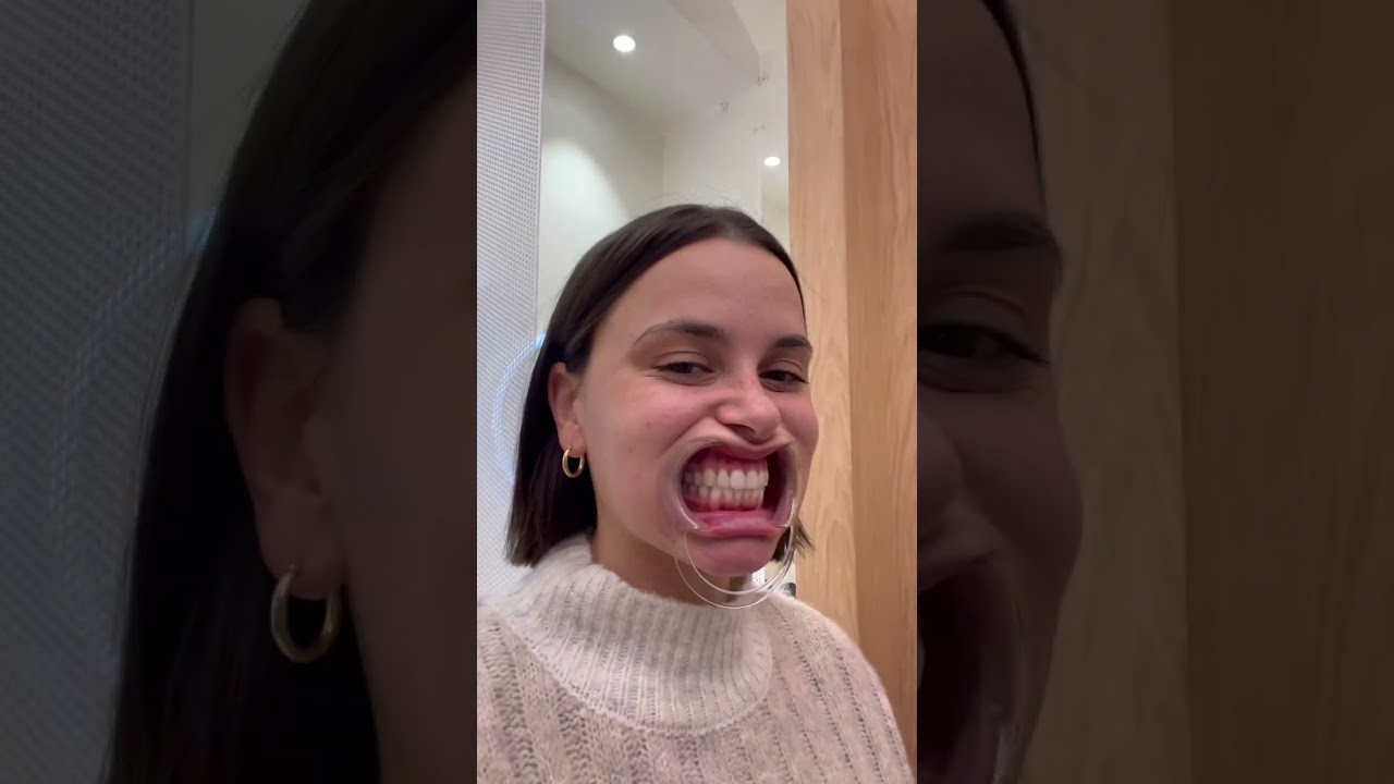 Visiting the SmileShop