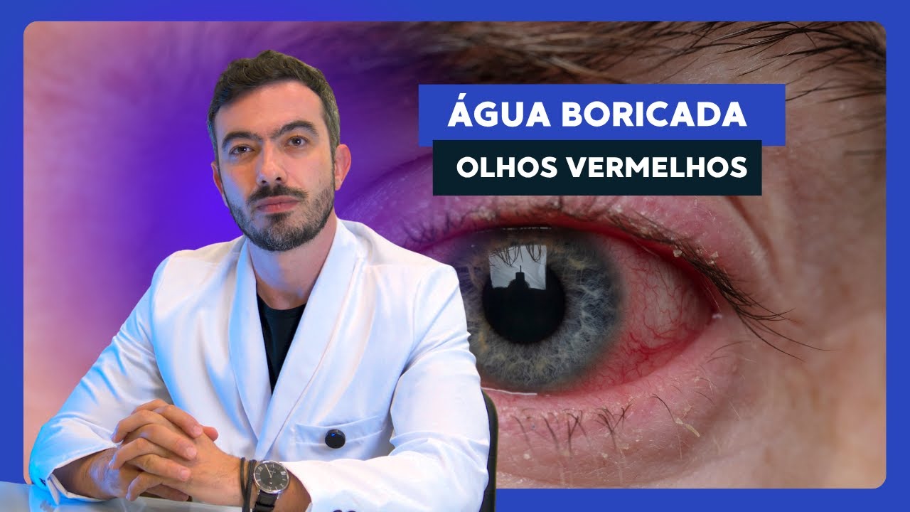 Água Boricada para Olhos Vermelhos