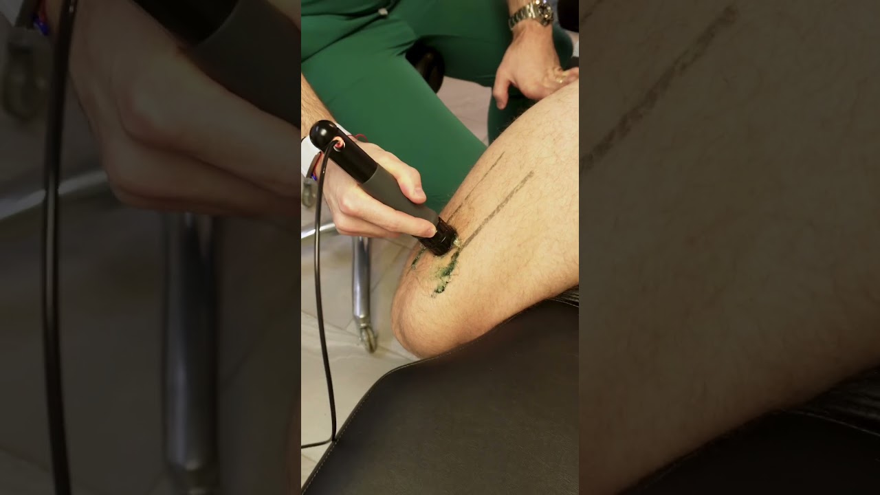 Если вы бегун, то эта квадрицепс нуждается в лечении…