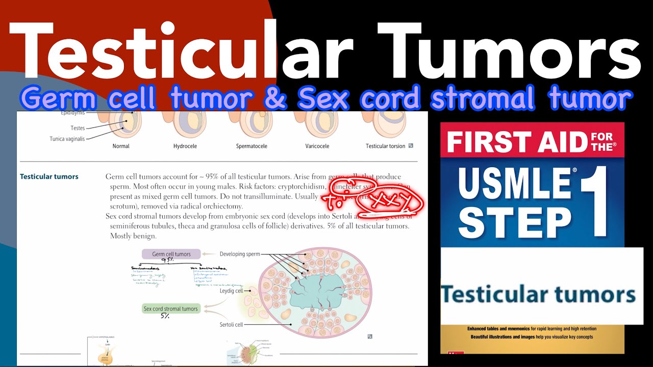 Testicular tumors- Germ cell tumor & sex cord stromal tumours in Hindi/Urdu by first aid for step 1