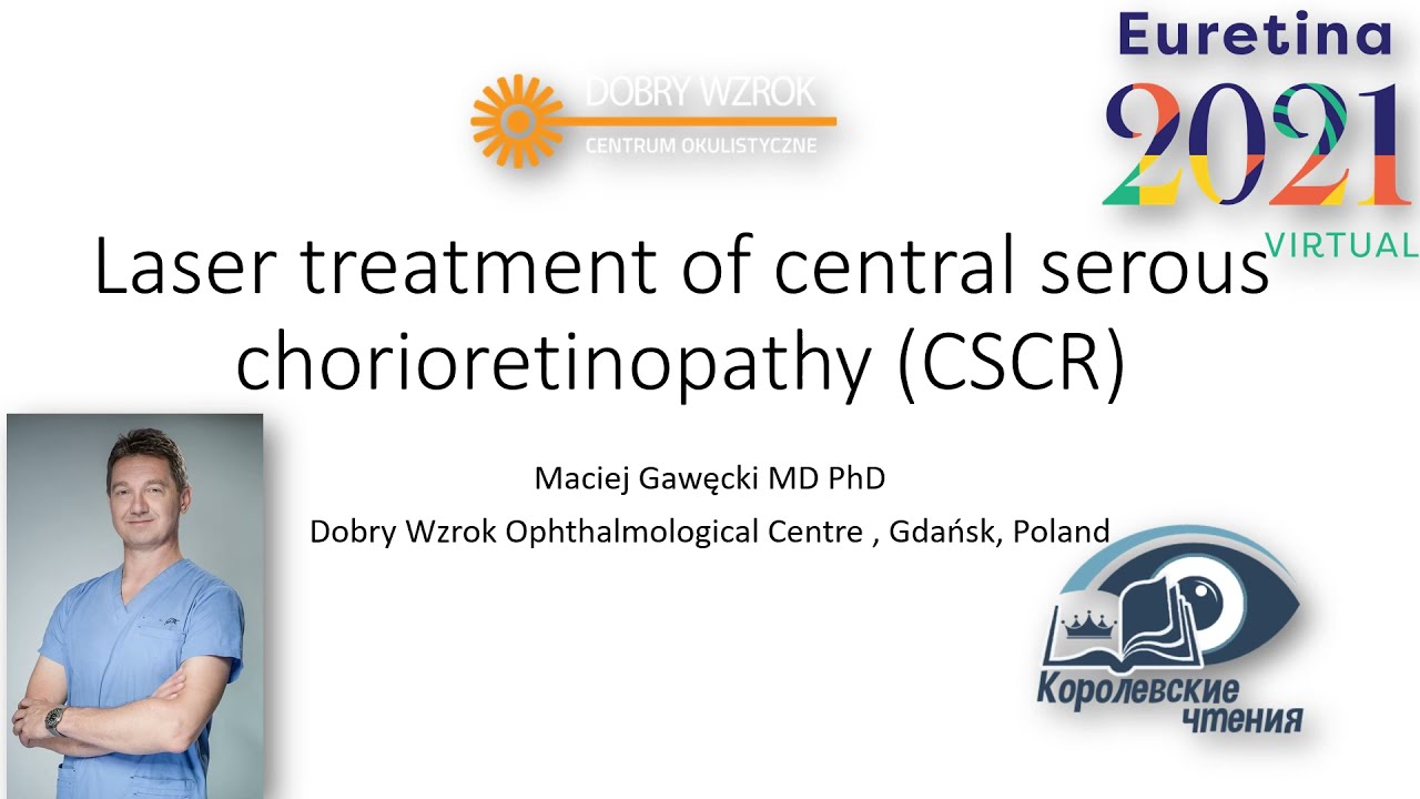 Laser treatment of central serous chorioretinopathy. Instructional course EURETINA 2021 Virtual