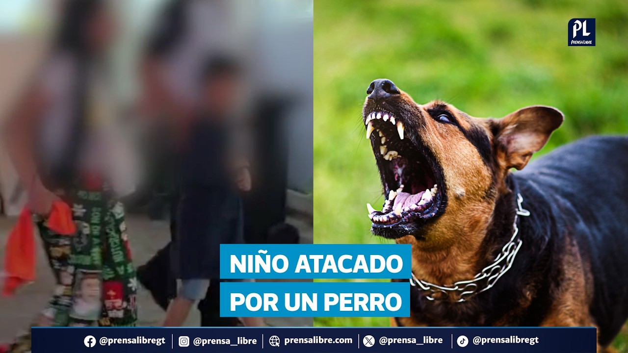 Niño de 7 años es atacado por perro en la zona 7 capitalina
