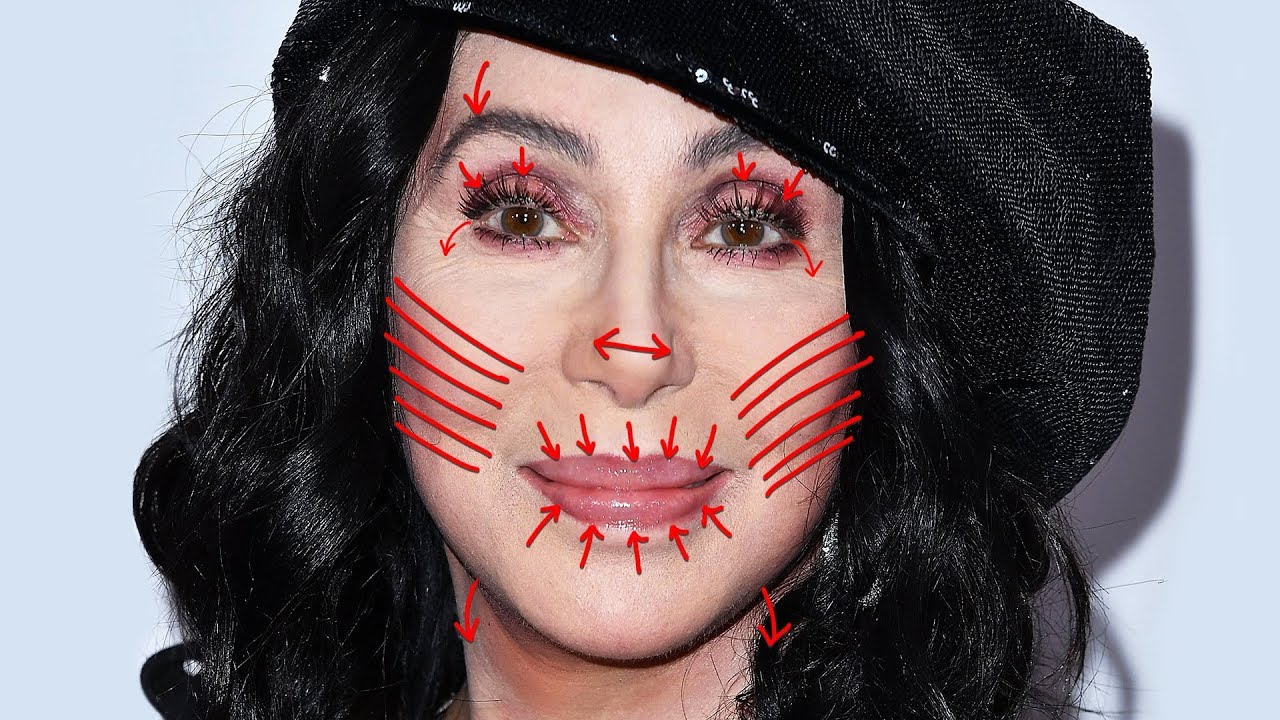 Removing CHER'S Plastic Surgery