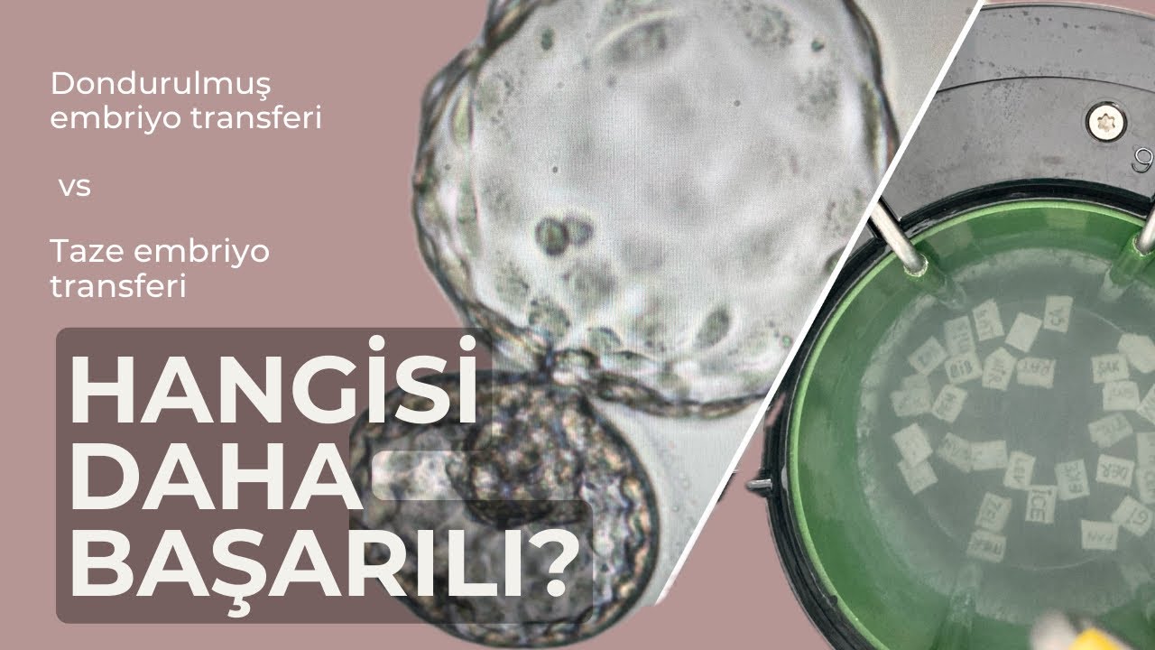 Hangisi daha başarılı: Dondurulmuş embriyo transferi mi yoksa taze embriyo transferi mi?
