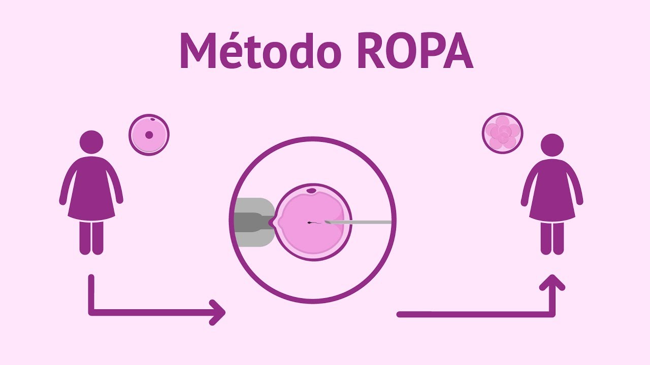 M&eacute;todo ROPA | Tratamiento para ser madres lesbianas