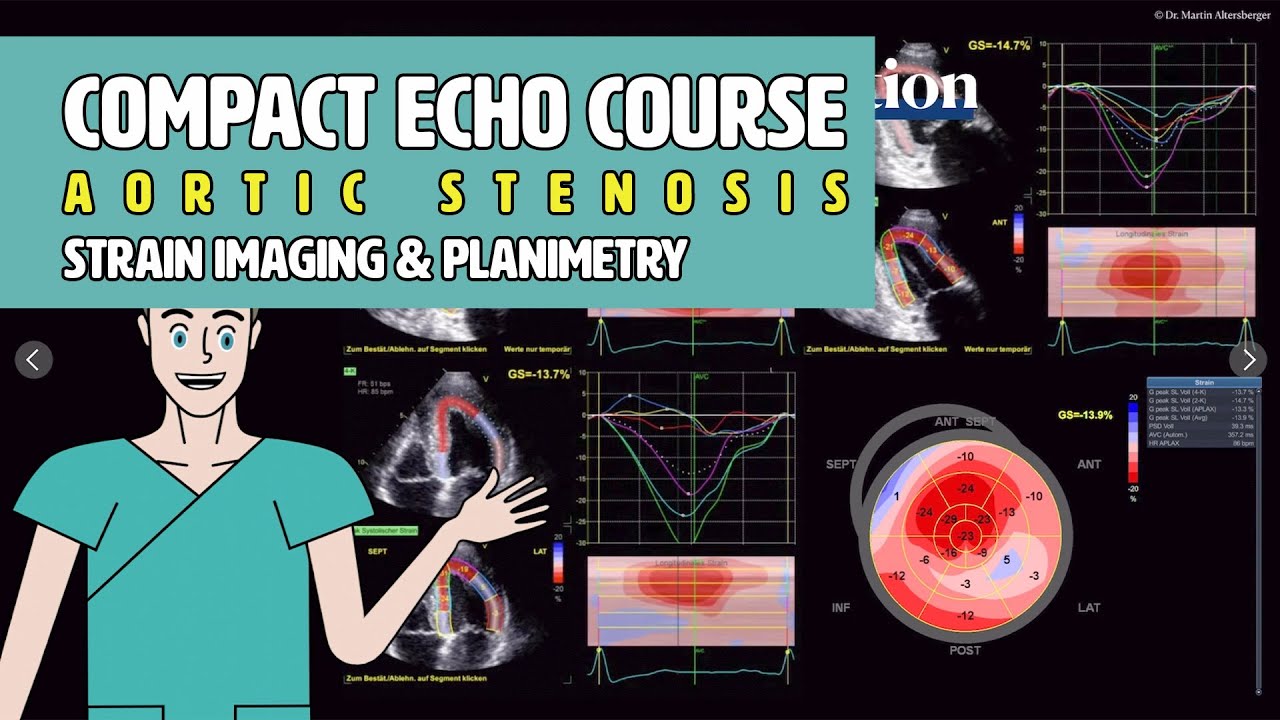 〖Echocardiography〗 Strain imaging & Planimetry in aortic stenosis ❣️