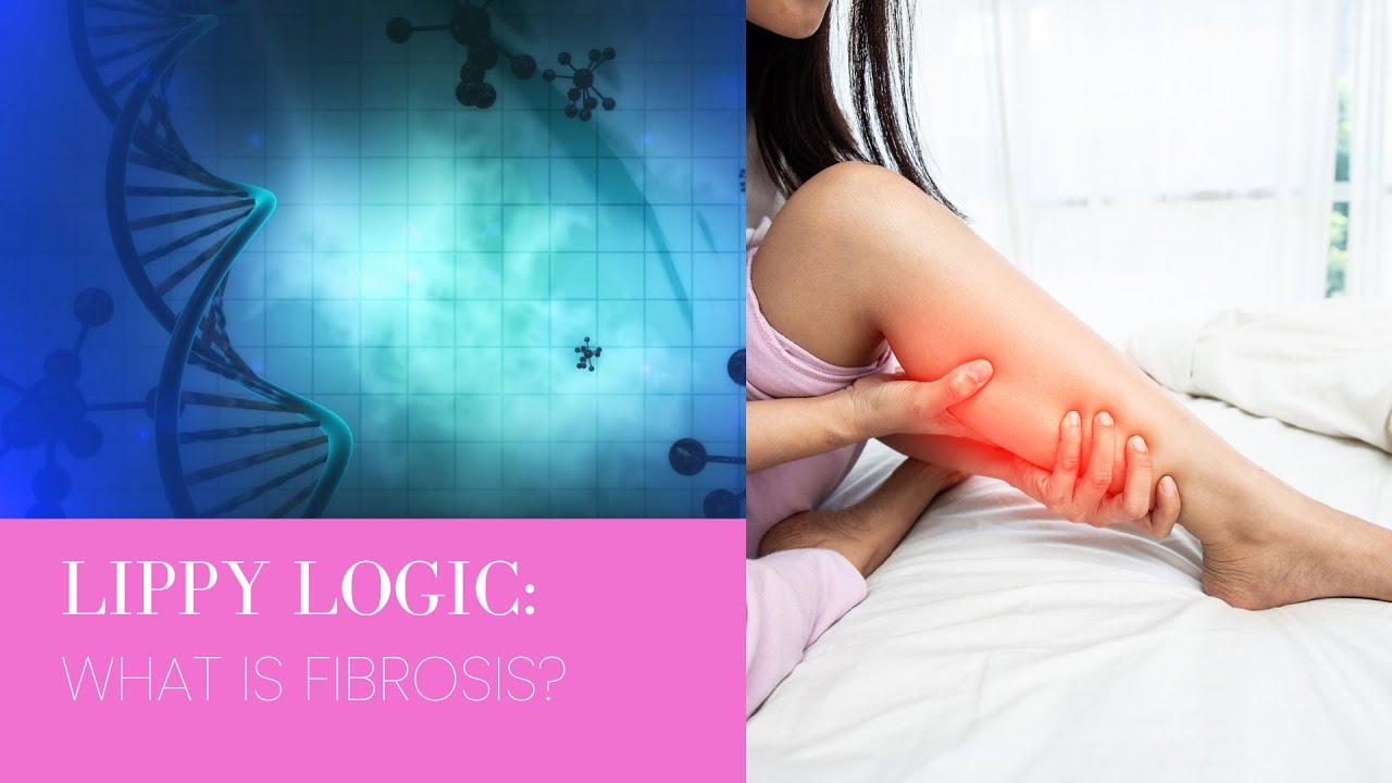 Lippy Logic™ | Episode 6: What is Fibrosis? | Dr. David Amron
