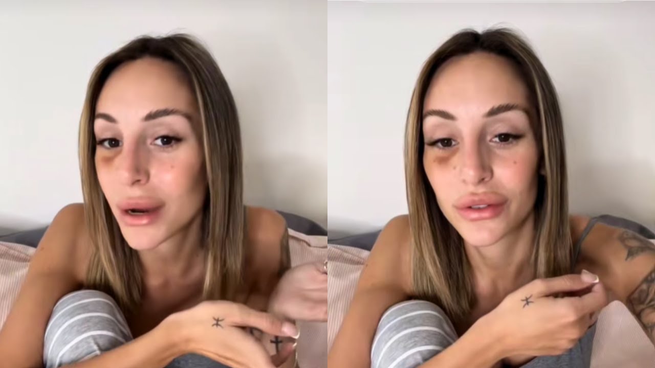 M&eacute;lanie ORL (La Villa des c&oelig;urs bris&eacute;s) en larmes : elle raconte les vi&oslash;lences subies par son ex 💔