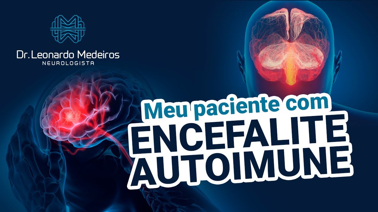 ENCEFALITE AUTOIMUNE: Estudo de caso