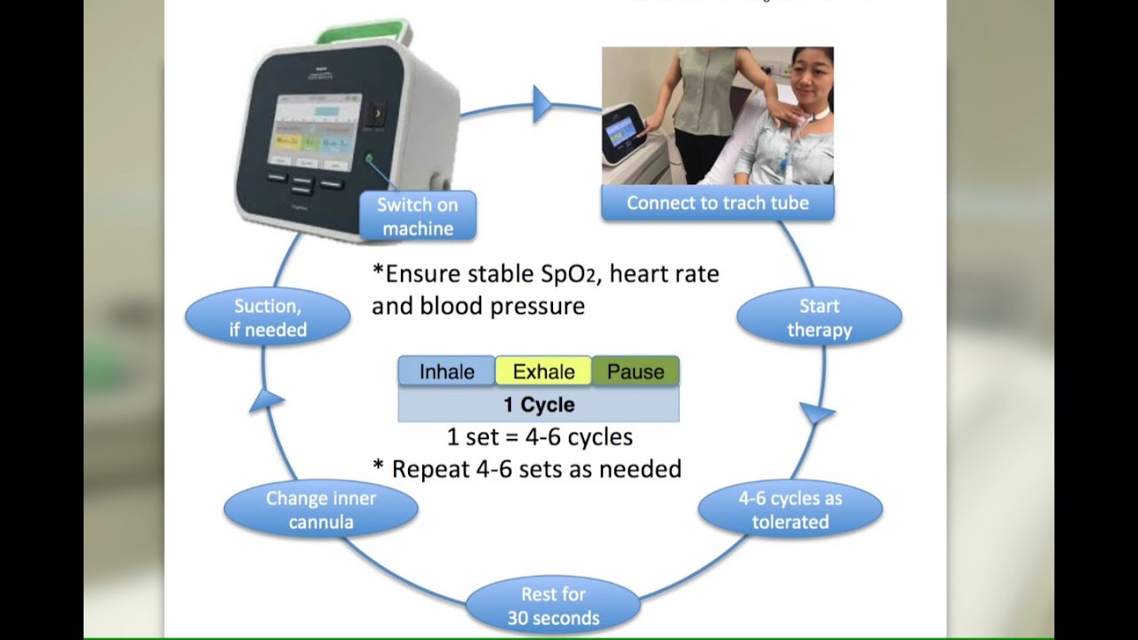 HVRSS 11. Cough Assist/ MIE (Mechanical Insufflation-Exsufflation)