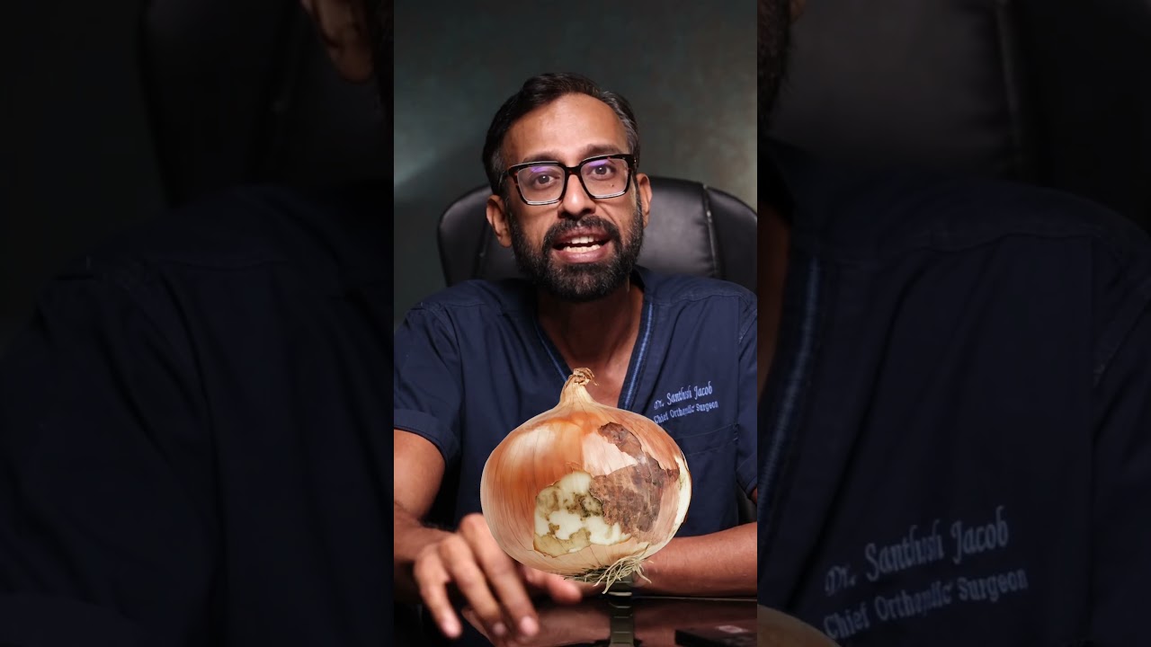 🧅 Onions with Black Lines &ndash; Safe or Not?