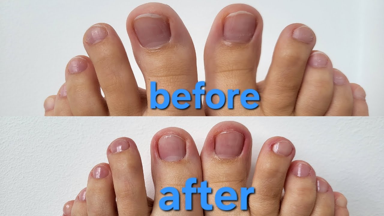 DIY Pedicure ✨ Barefoot Transformation Before & After