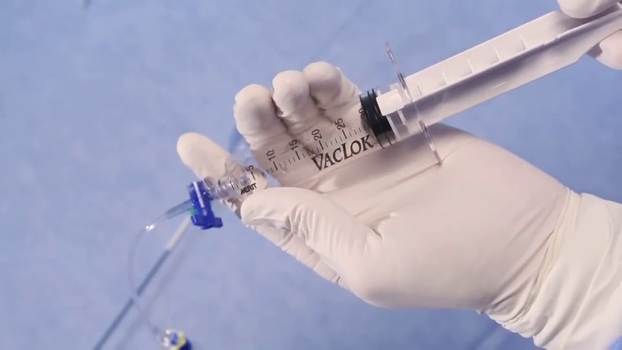Export Advance- A Thrombus Aspiration Catheter