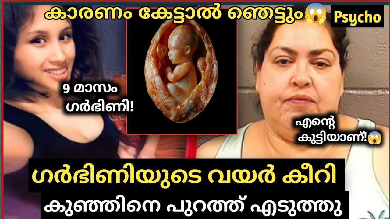 ഗർഭിണിയുടെ വയർ കീ *  കുഞ്ഞിനെ പുറത്ത് എടുത്ത് കൊന്നു 😰 | ഇങ്ങനെ ആർക്കും സംഭവിക്കാതിരിക്കട്ടെ!