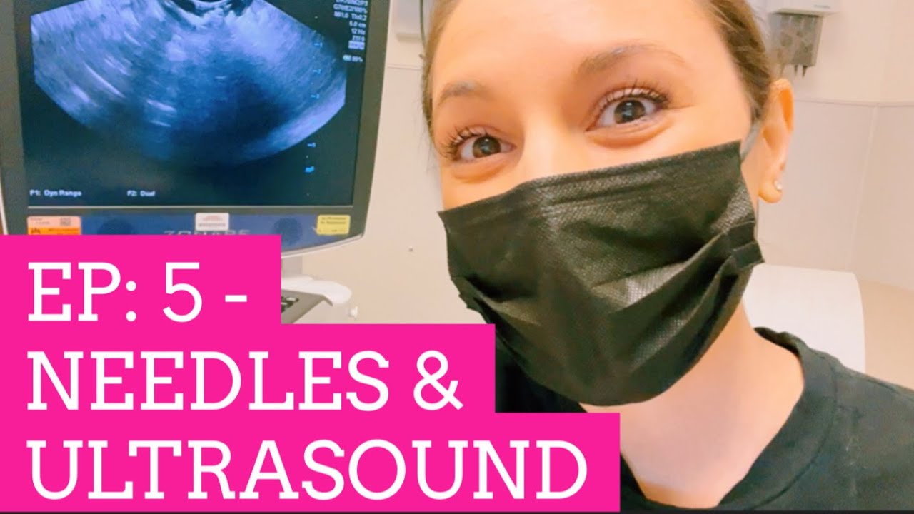 PREGNANCY 1ST ULTRASOUND & FEAR OF NEEDLES