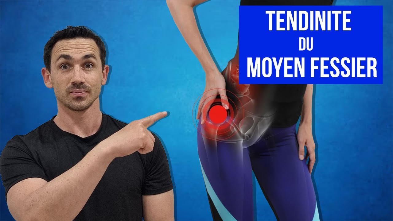 Tendinite du Moyen Fessier : Traitements, Étirements et Exercices Kiné