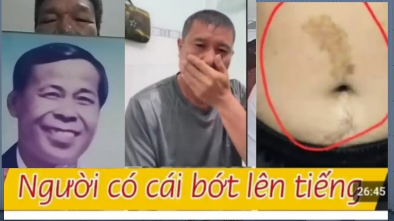 721 )  Giống quá . Hy vọng đúng là đứa em thất lạc lúc 6 tuổi đây rồi .