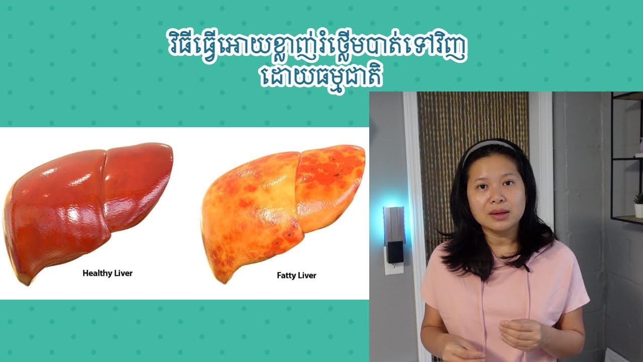 វិធីធ្វេីអោយខ្លាញ់រំថ្លេីមបាត់ទៅវិញ ដោយធម្មជាតិ
