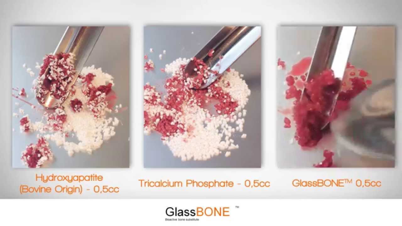 Noraker | Glassbone - Comparison Cohesiveness Blood Test
