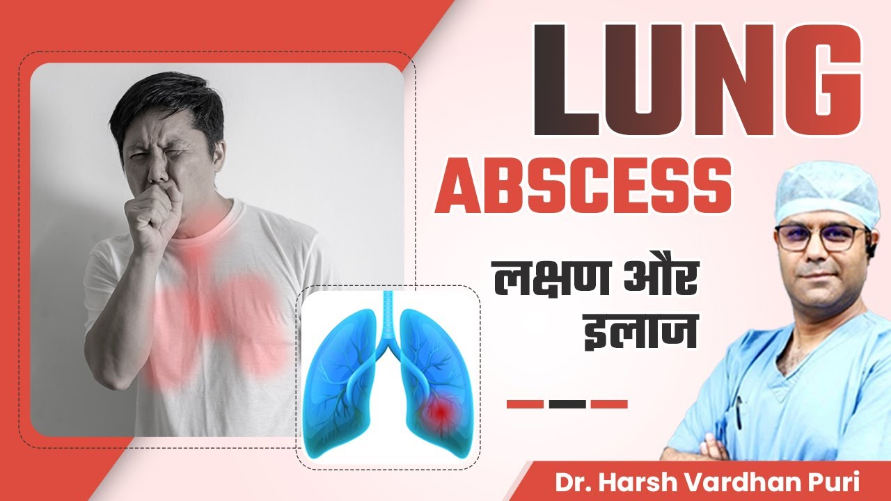 Lung Abscess: Symptoms, Diagnosis and Treatment | Dr. Harsh Vardhan Puri, Medanta