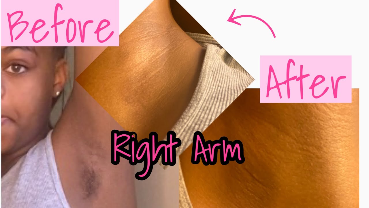 SURPRISE&hellip;.I WAX MY 9 YEAR OLD DAUGTHER ARMPITS FOR THE FIRST TIME