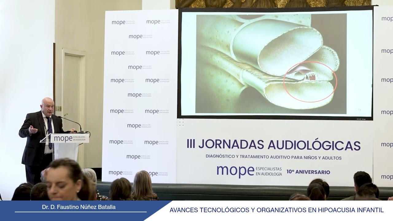 AVANCES TECNOLÓGICOS Y ORGANIZATIVOS EN HIPOACUSIA INFANTIL por Dr. D. Faustino Nuñez Batalla
