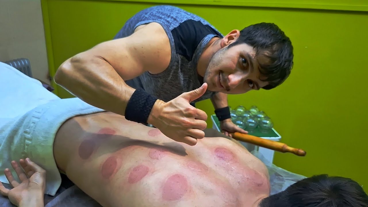 Releasing back muscles with Graston and cupping😍🫡🌿