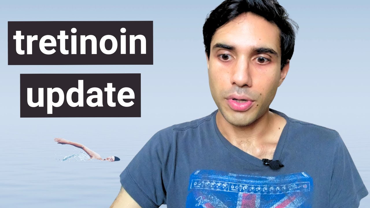 4 years later: why I switched to a lower strength retinoid (tretinoin)