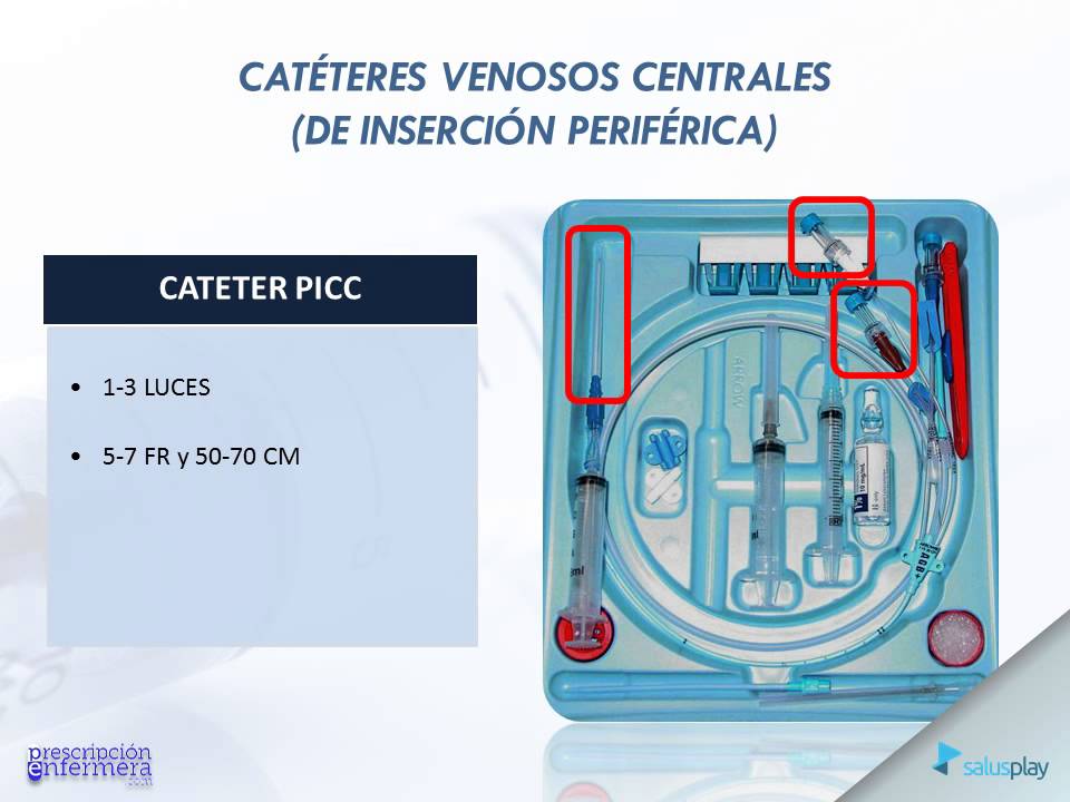 CATÉTERES