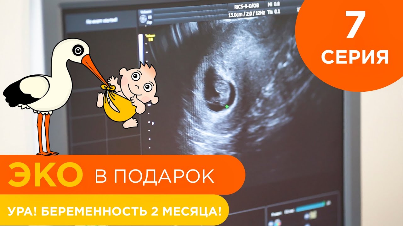 Ребенок для Марины - 7 серия - Ура! Беременность 2 месяца! | ЭКО в подарок с Ковалевской Ларисой